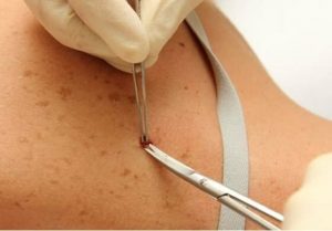 dermatologia clínica