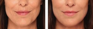 dermatologia estética